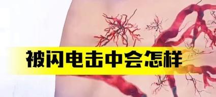 电源被闪电击中会发生什么？如何预防？
