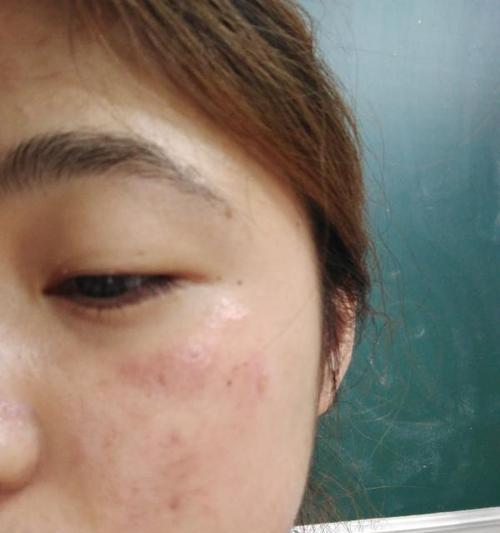 苹果手机流黄水无法充电的原因是什么？