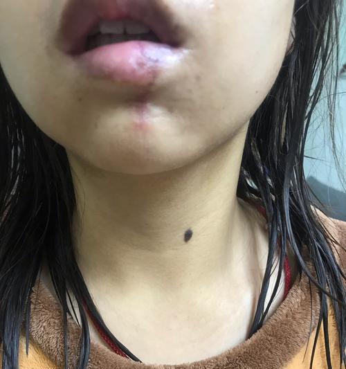 台式电脑下巴变宽如何解决？变宽后对使用有何影响？