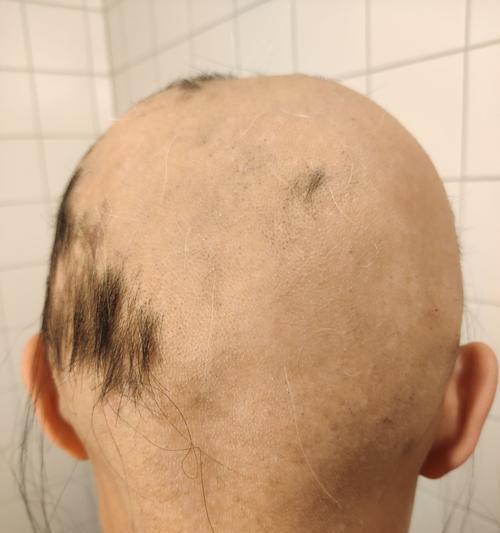 美颜相机斑秃如何恢复？操作步骤是什么？